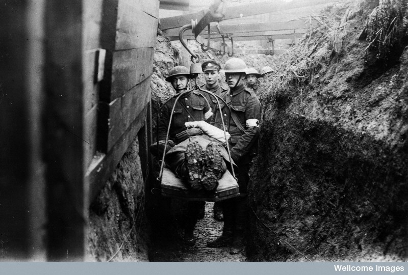 Carriage of the wounded in he trenches in World War One